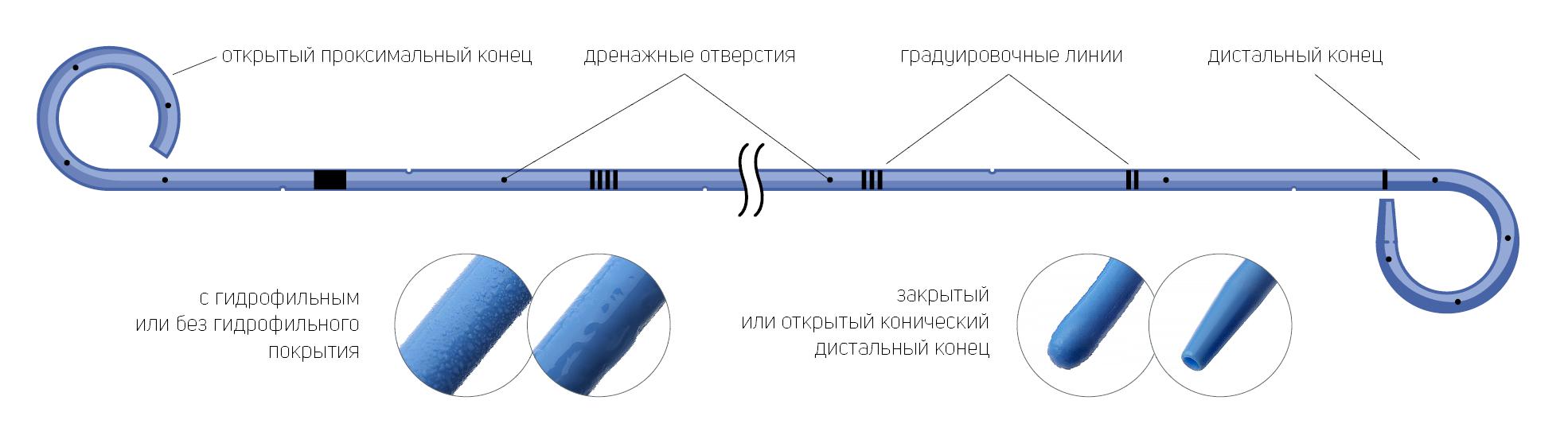 Как дренажные стенты меняют жизнь