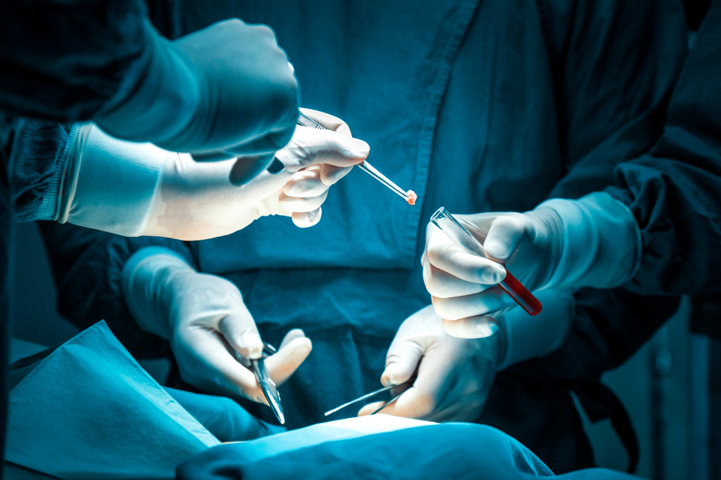 Общая биопсия: что это за процедура и как она проводится?