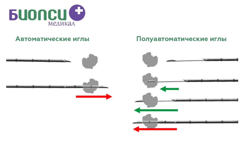 игла полуавтоматическая.jpg